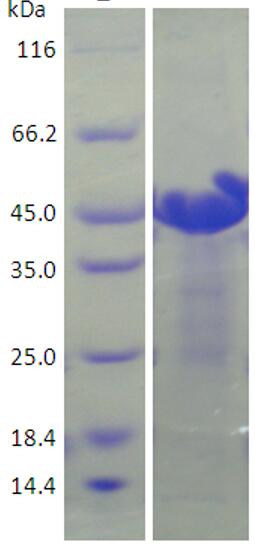 15% SDS-PAGE analysis profiles of purified KP1_1620-21-382 (CBB stained).